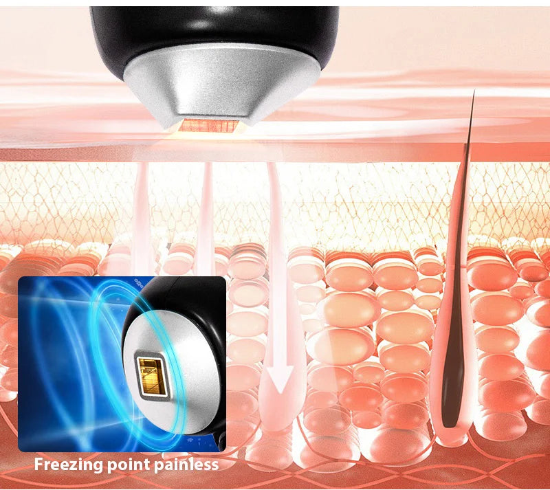 3500W Soprano Titanium Ice Platinum Diode 755 808 1064nm 3 Wavelength Laser Machine Painless Diode Hair Removal Machine